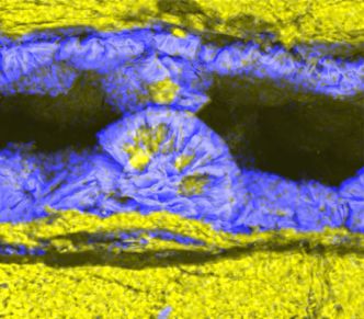 Forurensningsstoffet krom, i blått, adsorberes på dypingitt med blomsterlignende morfologi kalt «ørkenroser». Gult indikerer magnesium, som finnes både i dypingitt og på bergarten som dypingitt dannes på. Bildet er tatt med et skannings-elektronmikroskop. Foto:  Sintef