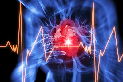 Ved hjelp av avansert matematikk har forskere ved Simula regnet seg fram til at hjerteinfarkt sannsynligvis kan føre til hjertesvikt.  
