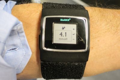 Armbånd for diabetikere: Med den nye norske multisensoren kan diabetikere få glukoseverdien rett på armen uten å stikke seg.