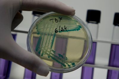 En petriskål med fremdyrkede E.coli-bakterier.