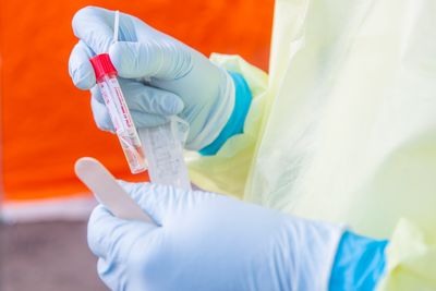 Norges politikk med å gjennomføre relativt få tester for koronavirus har møtt kritikk blant helsepersonell i de siste dagene.