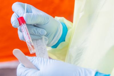 Norges politikk med å gjennomføre relativt få tester for koronavirus har møtt kritikk blant helsepersonell i de siste dagene.