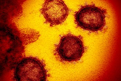 Mengder av virus i mange ulike former. Noen helt harmløse, noen sykdomsfremkallende og noen livsfarlige. SARS-CoV-2 som forårsaker sykdommen Covid-19 er ikke av de verste. 