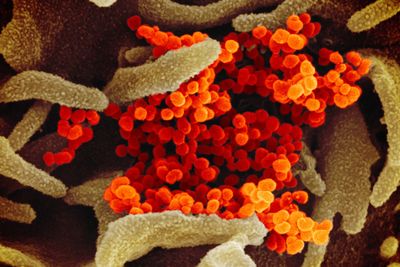 Barn har høyt nivå antistoffer i blodet og kan dermed kanskje være bedre beskyttet mot det nye koronaviruset.