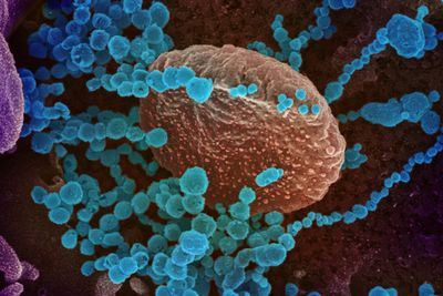 For fra flere hold mener nå forskerne at mange allerede i barneårene har dannet en brukbar immunitet. Det kan være forklaringen på at mange ikke blir smittet eller blir særlig syke, trass i at SARS-CoV-2 er et helt nytt virus.