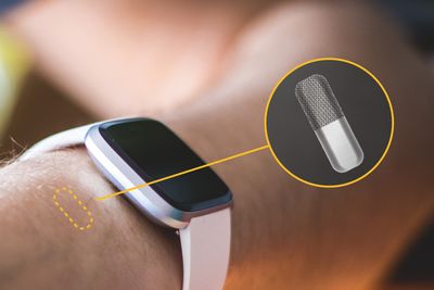 Dagens sensor fra Lifecare skal under huden ved håndleddet. Nå utvikler selskapet en variant, basert på samme prinsipp, som skal inn i bukhulen og være en del av en kunstig bukspyttkjertel.