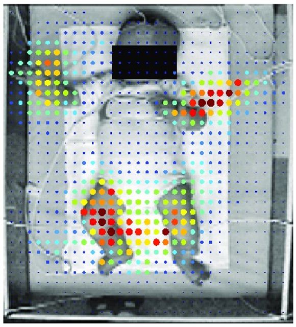 Robotsyn kan brukes til å lese spebarns bevegelser for å finne ut om de er rammet av Cerebral Parese. <i>Foto: NTNU, St. Olavs Hospital</i>
