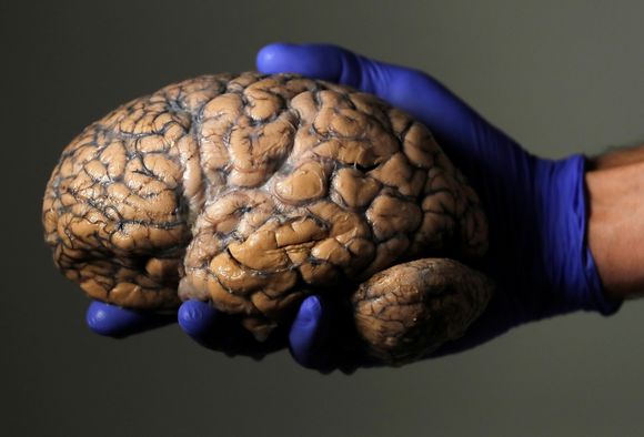 En menneskehjerne holdt opp av den belgiske forskeren Jeroen Schuerman. På tross av all sin kompleksitet, er hjernen langt enklere å forstå seg på enn de intrikate sammenhengene i verdens økosystemer. <i>Foto:  YVES HERMAN/NTB Scanpix</i>