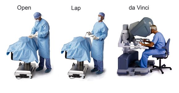 Utvikling av kirurgi: Det er ikke slutt med åpen kirurgi, men stadig mer gjøres uten å åpne pasienten via instrumenter som føres inn. Robotkirurgi er en svært avansert dataassistert utvikling av den manuell måten å gjøre det på. <i>Foto:  Da Vinci</i>
