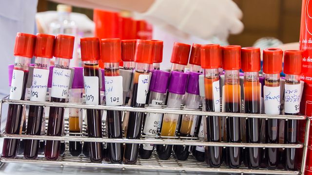Norsk firma vil gi deg svar på blodprøvene dine