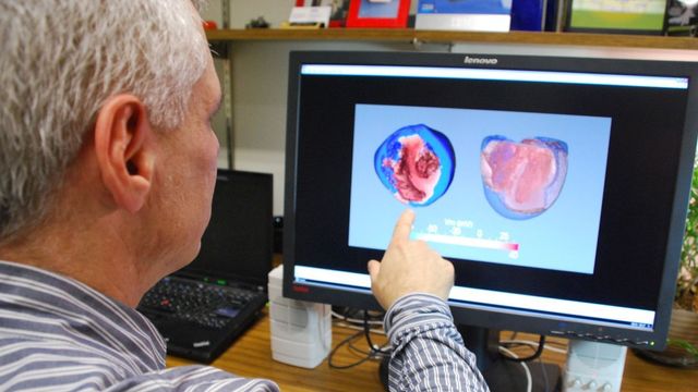 Nå simulerer den menneskehjertet