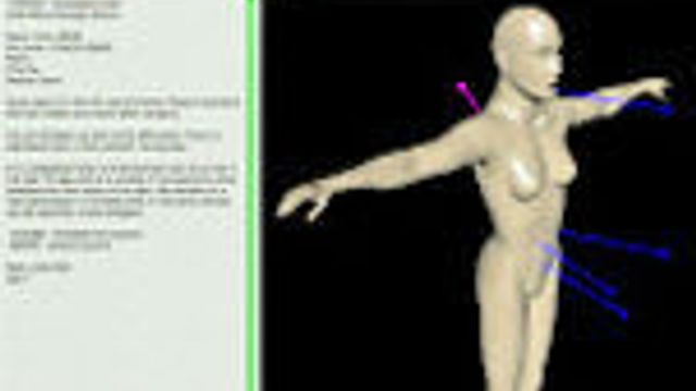 Vil bruke 3D-teknologi til pasientbehandling