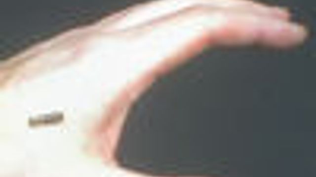 Forbyr tvungne ID-implantater