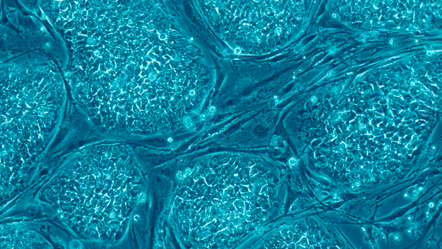 Hvordan forskes det på stamceller? 