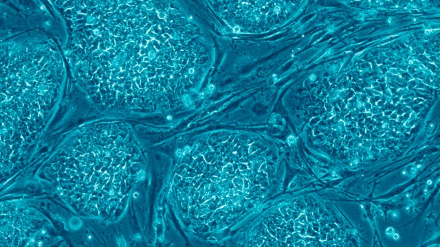 Hvordan forskes det på stamceller? 