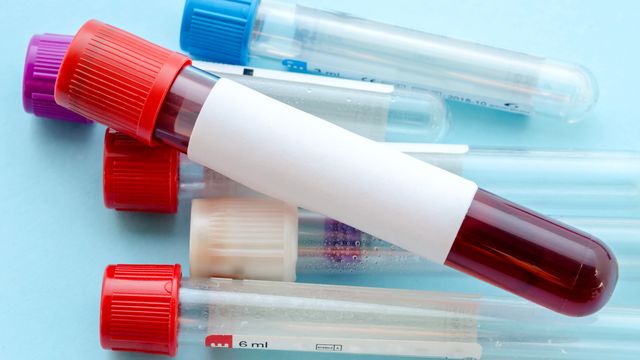 Norske forskere ser etter tidlige tarmkrefttegn i blodprøver