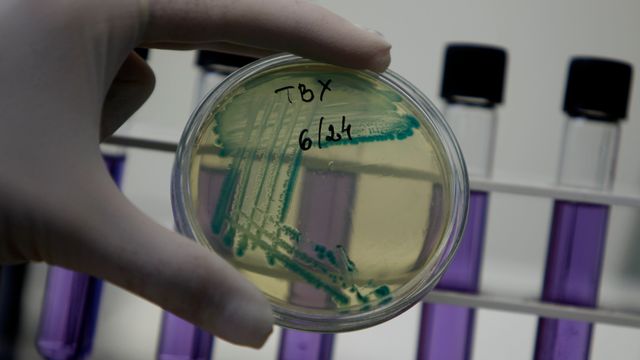 Kunstig intelligens fant nytt kraftig antibiotika