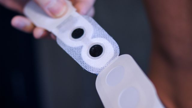 Norskutviklet smartplaster kan overvåke væske- og saltbalansen. Det er bedre for pasienten og billigere for helsevesenet