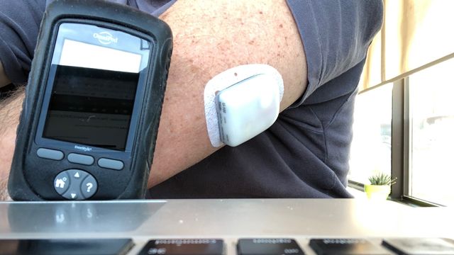 Insulinpumper som brukes i Norge, kan hackes: – Man kan miste bevisstheten og få kramper