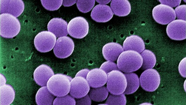 Forskarar driv kjemisk detektivarbeid for å bekjempa antibiotikaresistens