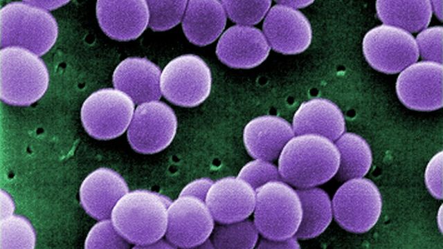 Forskarar driv kjemisk detektivarbeid for å bekjempa antibiotikaresistens