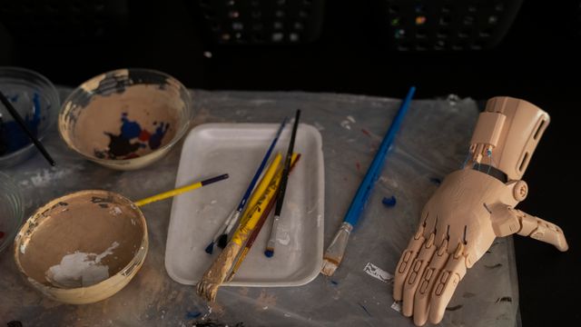 Mia (11) fikk 3D-printet hender: – Nå kan jeg holde pennen igjen