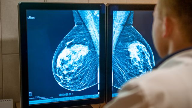 Får KI-hjelp til å granske mammografi-bilder – finner oftere kreft