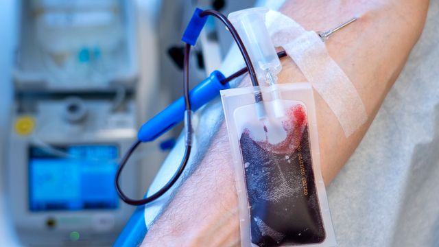 Akutt blodinnsamling etter hackerangrep mot flere London-sykehus