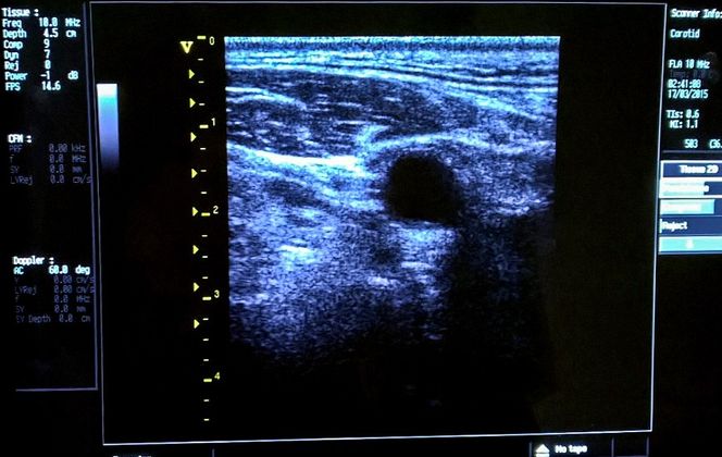 Ultralyd: Ringen i midten er journalistens halspulsåre.