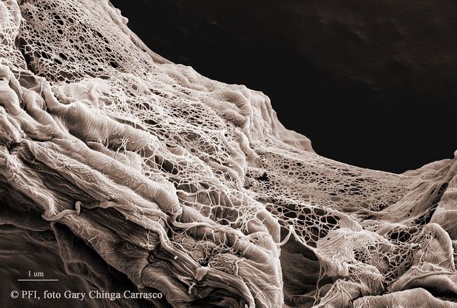 Man må bruke sterk forstørrelse for å kunne se de enkelte fibrillene, som i dette bildet hvor de fleste fibrillene har diameter på ca. 15 nanometer. Foto: Gary Chinga Carrasco