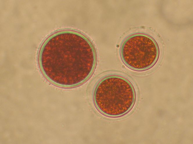 Algen «Haematocuccus pluvialis» produserer et stoff som kalles Astaxanthin. Dette er verdens kraftigste antioksidant, og brukes blant annet i kjente kosttilskudd.