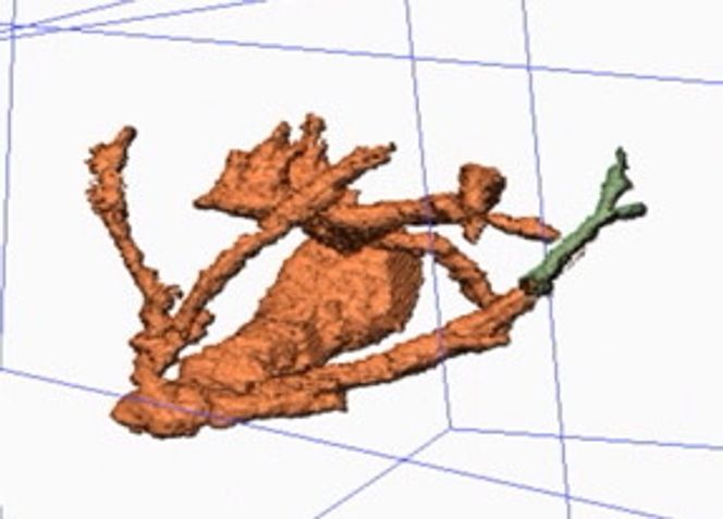 En ny teknikk reduserer støy i 3D-bildene samtidig som den bevarer detaljene.