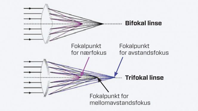 Fokalpunkter: Skjematisk illustrasjon av diffraktiv bifokal og trifokal linse. Blått fokus gir klart syn på avstand, sort på mellomavstand og rosa på nært hold. Disse styrkene samtidig i en og samme linse gjør det mulig å se på ulike avstander uten briller. Kilde: Memira