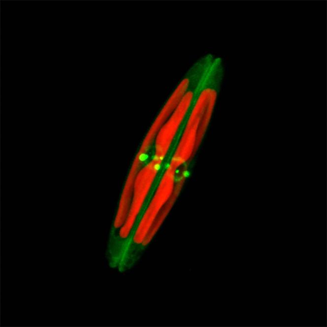Mikroskopbilde av en mikroalge av slekten Seminavis. Dette er en av algetypene som det skal gjøres forsøk med