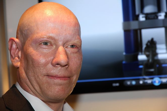 Merket: Petter Birkeland(44) trodde oppfinnelsen hans med den unike kuttemaskinen var over da han våknet fra koma. Nå har han solgt den første maskinen til Statoil. Foto: Tormod Haugstad