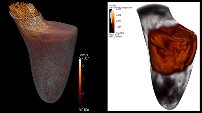 Datasimulering av blodstrømmen i hjertets venstre kammer.