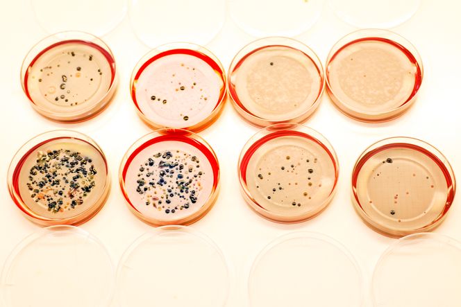 Medisinerte bakterier: Bakteriene nederst til venstre har ikke blitt utsatt for antibiotika, mens man kan se hvordan de andre opptrer når de blir «medisinert».