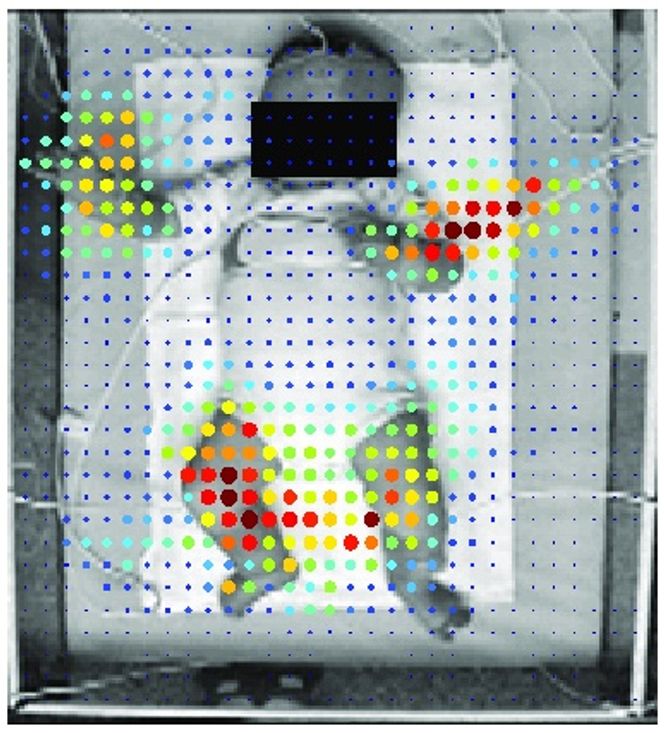 Robotsyn kan brukes til å lese spebarns bevegelser for å finne ut om de er rammet av Cerebral Parese. Foto: NTNU, St. Olavs Hospital