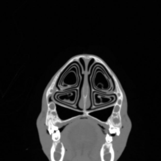 Reinsdyrnesen innvendig har en uvanlig og underlig struktur. Den ligner på en konkylie, noe som gjør at den indre overflaten er veldig stor. Foto: Rune Sundset/Mario Acquarone