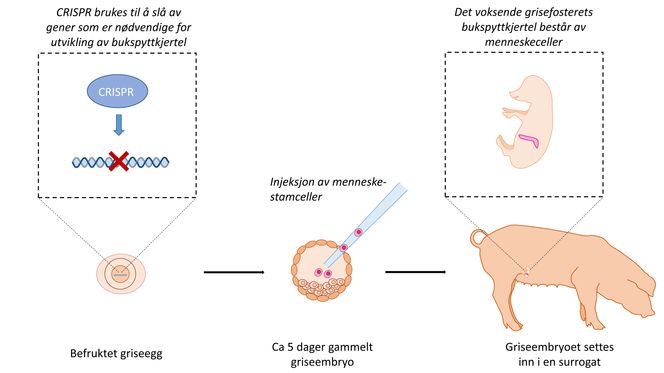 Det kan være mulig å få en gris til å produsere en ny bukspyttkjertel på bestilling. Den vil være bygget av genene til den som trenger å få transplantert inn en ny, ved hjelp av gensaksen Crispr. Med den er det mulig å skru av genene som skal til for å få et grise-embryo til å utvikle organet, men ved å sette inn stamceller fra pasienten, vil det utvikles et organ som er genetisk likt en menneskelig bukspyttkjertel. Teoretisk vil den kunne transplanteres inn uten avstøtning. 