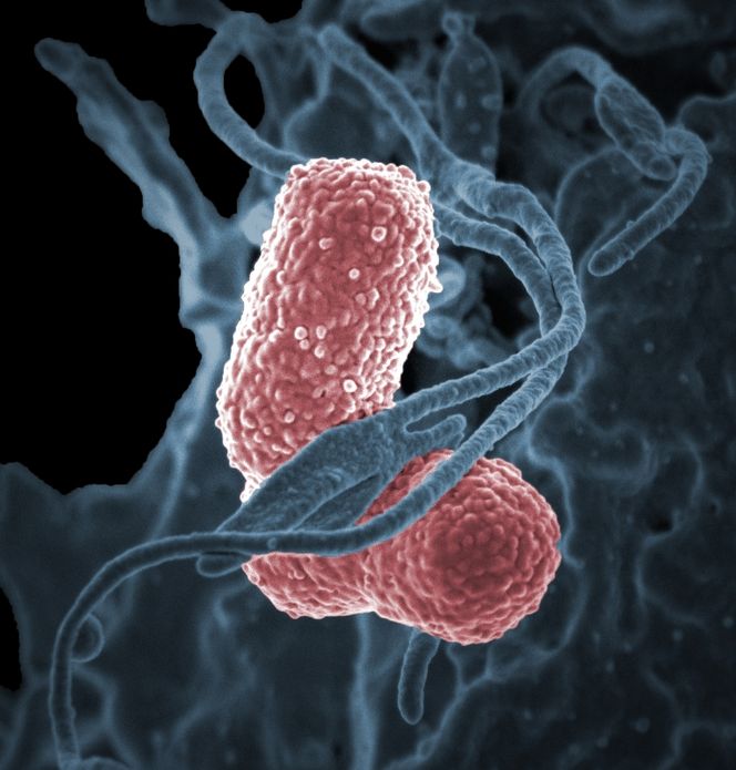 Klebsiella pneumonia er en vanlig tarmbakterie, som stort sett alle mennesker lever godt med. Problemet oppstår når du er syk eller under behandling. Har du tatt en operasjon eller er under for eksempel kreftbehandling, vil immunforsvaret være svekket. Utfordringen da er at de resistente bakteriene begynner å ta bolig i våre sykehus. Foto: National Institute of Allergy and Infectious Diseases, National Institutes of Health. Lisens