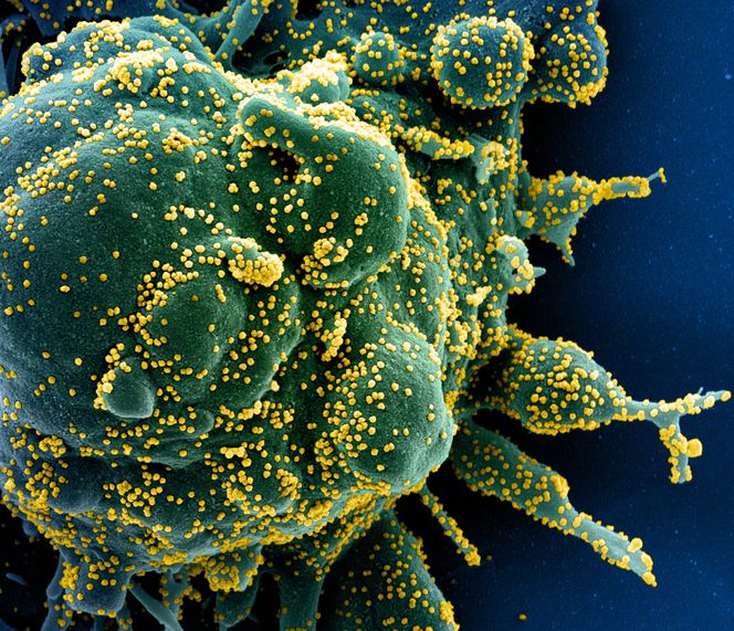 Koronavirus. Foto:  NIAI
