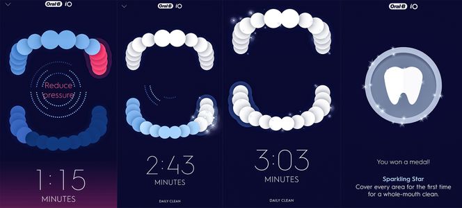 Det tok over tre minutter å bli premiert med medalje for skinnende rene tenner. Foto: Odd Richard Valmot