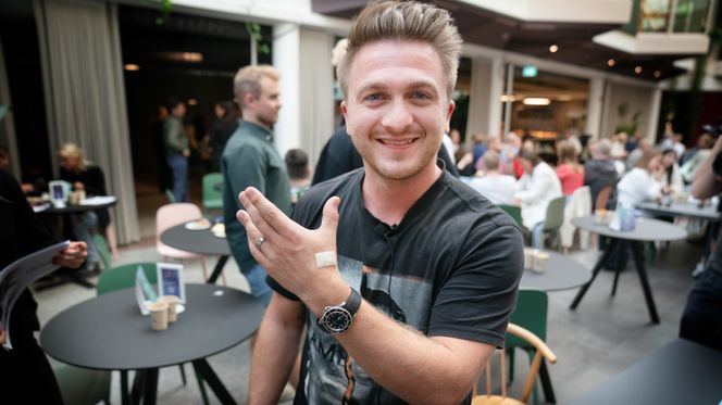 Fintech-sjefen Axel Hunter er fornøyd etter å ha fått satt to chip-implantater. Foto: Eirik Helland Urke