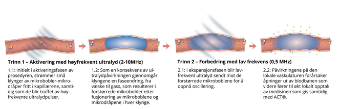 Prinsippet for «Acoustic Cluster Therapy», ACT. Illustrasjon:  Exact Therapeutics