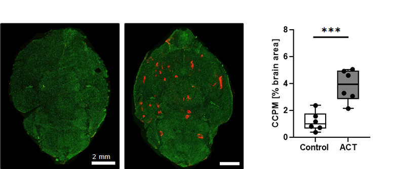 Figuren viser røde nanopartikler som har passert blod-hjernebarrieren (farget i grønn) og kommet inn i hjernevevet etter ACT-behandling . Til venstre ser vi at ingen røde nanopartikler passerer blod-hjernebarrieren i ubehandlet hjerne. Til høyre vises økningen (3,7 ganger mer) av antall nanopartikler (kalt CCPM) etter ACT-behandling sammenliknet med ubehandlet kontroll. <i>Illustrasjon:  NTNU</i>