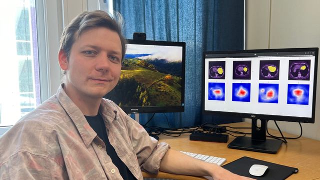 Finner leverkreft med kunstig intelligens