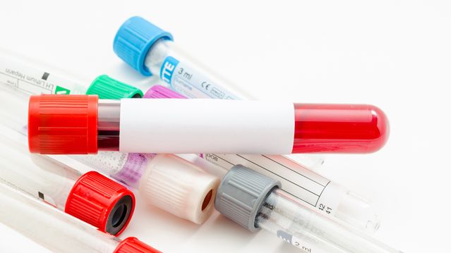 Hackere publiserer blodprøve-data fra London-sykehus